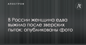У Росії жінка ледь вижила після звірячих катувань: опубліковано фото