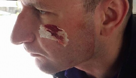 Під Тернополем прямо під час зйомки програми жорстоко побили журналістів: опубліковано фото і відео