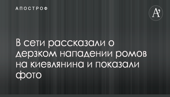 Уругвай - Франція: прогноз букмекерів на матч ЧС-2018