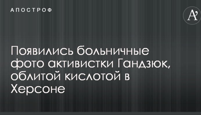 Появились больничные фото активистки Гандзюк, облитой кислотой в Херсоне