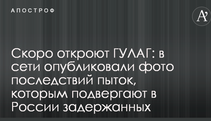 Скоро відкриють ГУЛАГ: в мережі опублікували фото наслідків тортур, яким піддають в Росії затриманих
