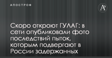 Скоро відкриють ГУЛАГ: в мережі опублікували фото наслідків тортур, яким піддають в Росії затриманих
