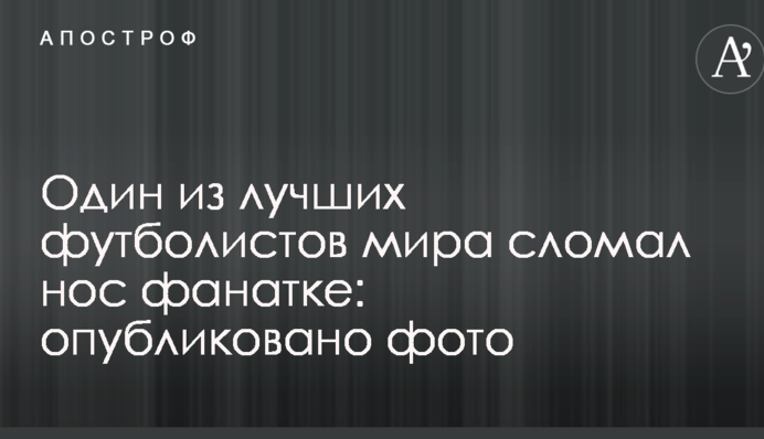 Один з найкращих футболістів світу зламав ніс фанатці: опубліковано фото