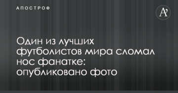 Один из лучших футболистов мира сломал нос фанатке: опубликовано фото