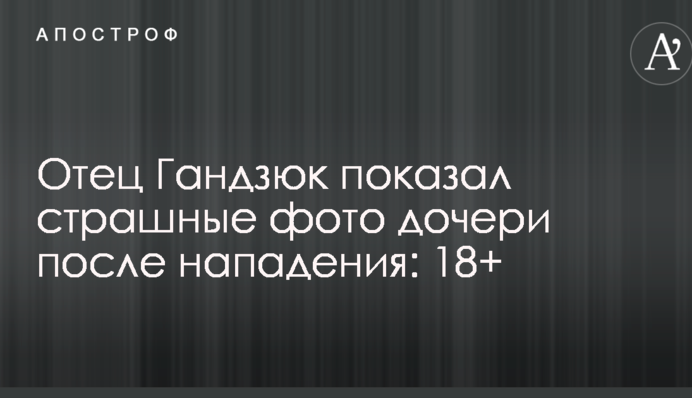 Отец Гандзюк показал страшные фото дочери после нападения: 18+