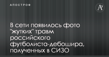 В сети появилось фото "жутких" травм российского футболиста-дебошира, полученных в СИЗО