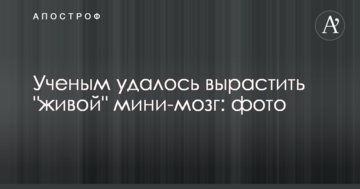 Вченим вдалося виростити "живий" міні-мозок: фото