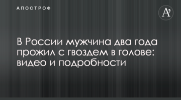​У Росії чоловік два роки прожив з цвяхом в голові: відео та подробиці