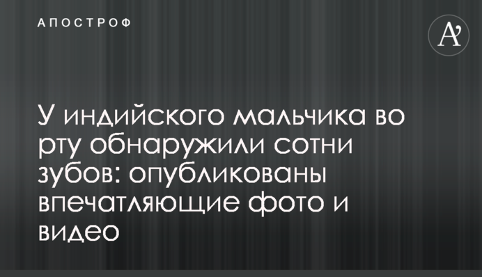У индийского мальчика во рту обнаружили сотни зубов: опубликованы впечатляющие фото и видео