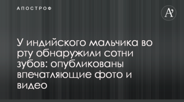 У індійського хлопчика в роті виявили сотні зубів: опубліковано вражаючі фото і відео