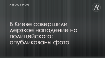 У Києві скоїли зухвалий напад на поліцейського: опубліковано фото