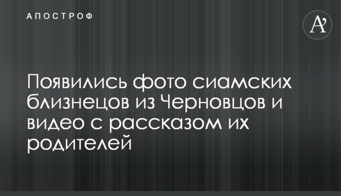З'явилися фото сіамських близнюків з Чернівців та відео з розповіддю їх батьків