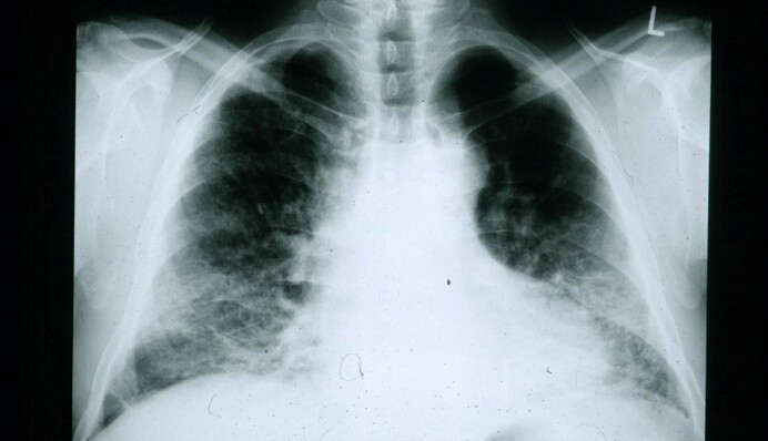 Вчені з'ясували, чим небезпечні занадто довгий і дуже короткий сон