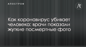 Як коронавірус вбиває людину: лікарі показали страшні посмертні фото