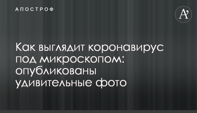 Як виглядає коронавірус під мікроскопом: опубліковано дивовижні фото