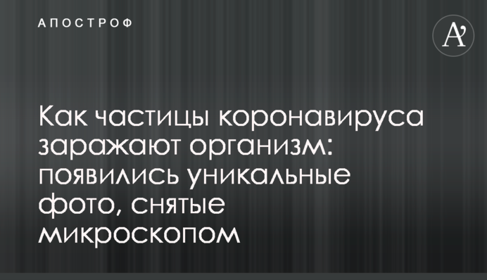 Как частицы коронавируса заражают организм: появились уникальные фото, снятые микроскопом