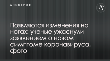 З'являються зміни на ногах: вчені жахнули заявою про новий симптом коронавірусу, фото