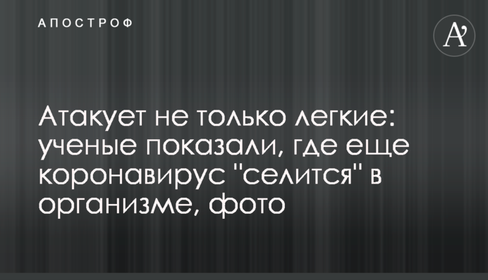 Атакує не тільки легені: вчені показали, де ще коронавірус 