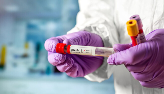 Хвороба не відступила: свіжі цифри по коронавірусу в Києві на 25 червня