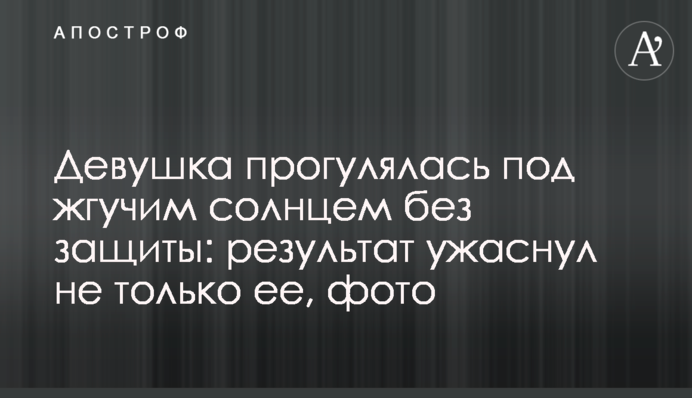 Дівчина прогулялася під пекучим сонцем без захисту: результат нажахав не тільки її, фото
