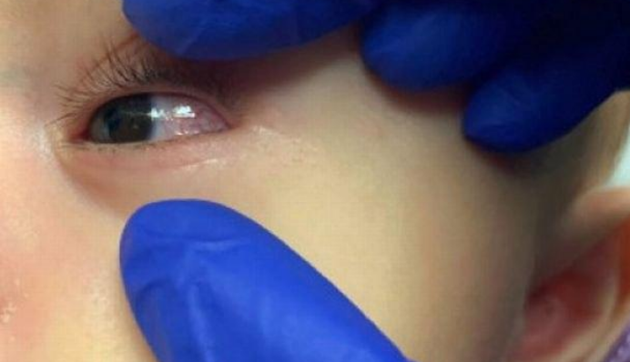 Детей начал убивать синдром, связанный с коронавирусом: его симптомы показали на фото