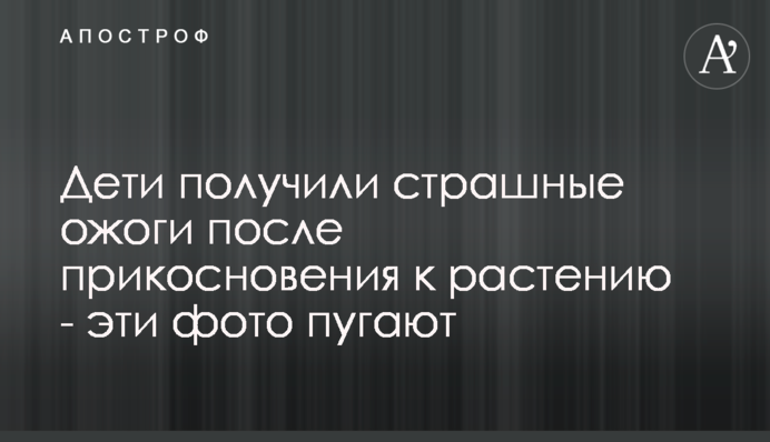 Діти отримали страшні опіки після дотику до рослини - ці фото лякають
