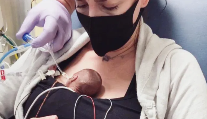 Дитина народилася на 22-му тижні і вижила - її дивовижну історію звуть 