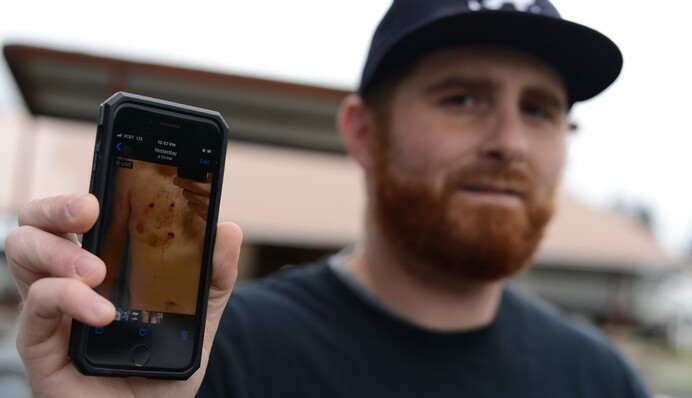 Огромный медведь ворвался в дом с 10 детьми - отец семейства дал отпор зверю