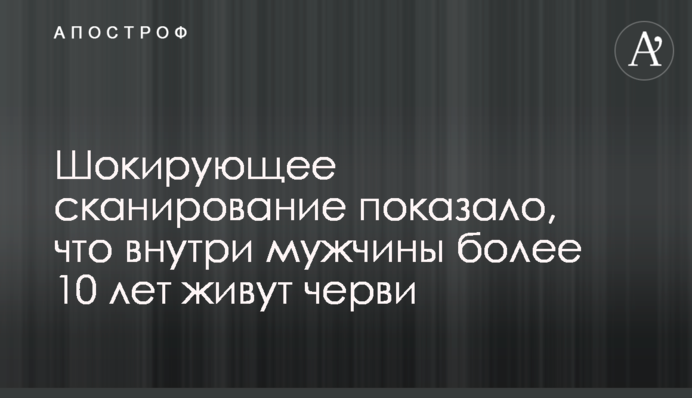 Шокуюче сканування показало, що всередині чоловіка більше 10 років живуть черви