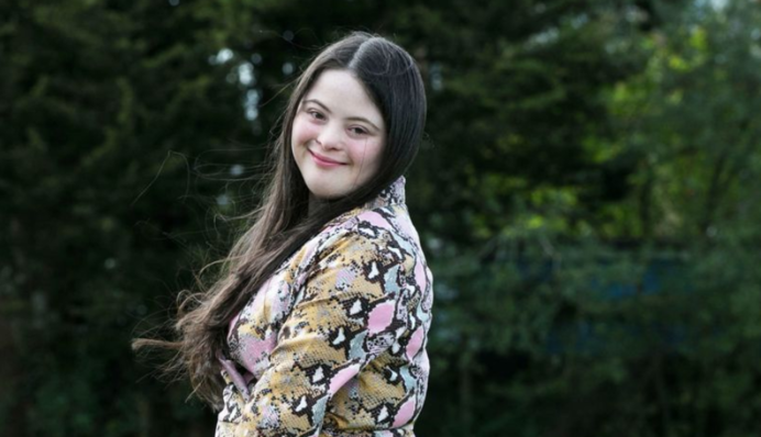 Дівчина з синдромом Дауна, яку медики списали з рахунків, стала моделлю Gucci