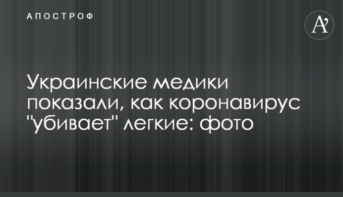 Украинские медики показали, как коронавирус 