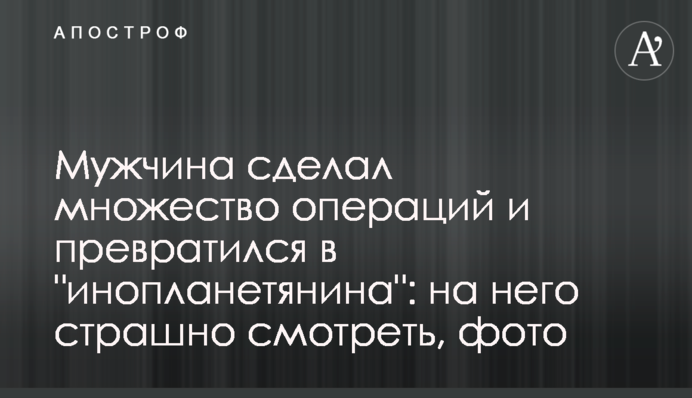 Мужчина сделал множество операций и превратился в 
