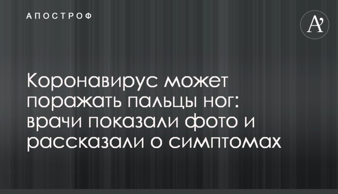 Коронавірус може вражати пальці ніг: лікарі показали фото і розповіли про симптоми