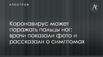 Коронавирус может поражать пальцы ног: врачи показали фото и рассказали о симптомах