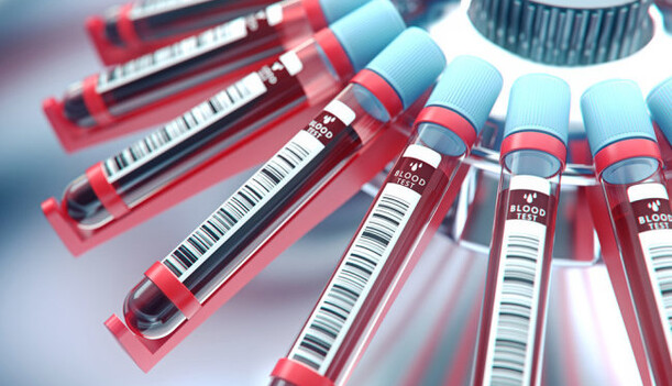 Вчені з'ясували, при якій групі крові мінімальний ризик зараження Covid-19