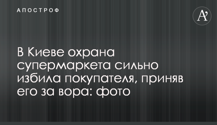 У Києві охорона супермаркету сильно побила покупця, прийнявши його за злодія: фото