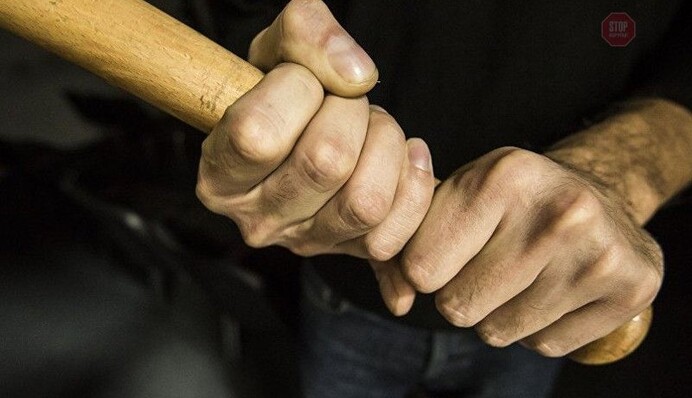 Під Харковом люди з битами жорстоко побили екс-міністра, довелося зашивати голову: фото