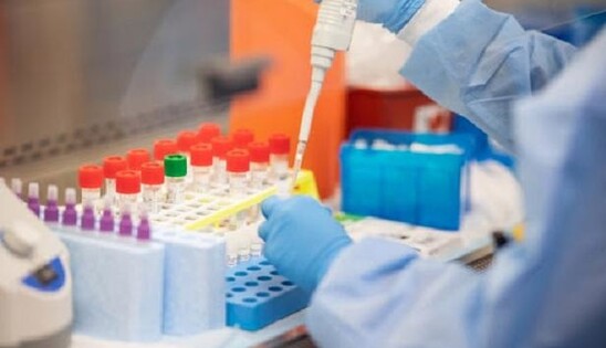 ПЛР-тести на коронавірус в Україні масово брешуть: що не так і як отримати точний результат