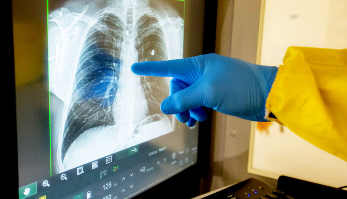 Ученые обнаружили 