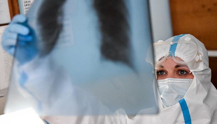 Куди б'є коронавірус: медики назвали головні ускладнення COVID-19