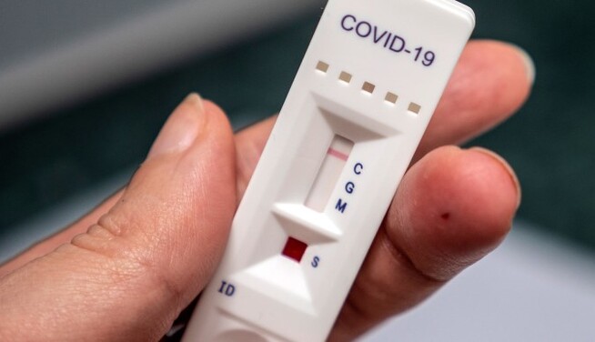 Украинцев начнут тестировать на антиген к коронавирусу: чем тест отличается от ПЦР