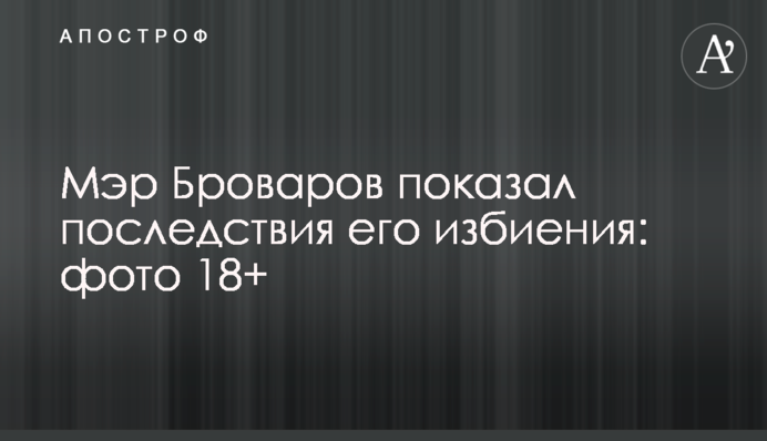 Мэр Броваров показал последствия его избиения: фото 18+