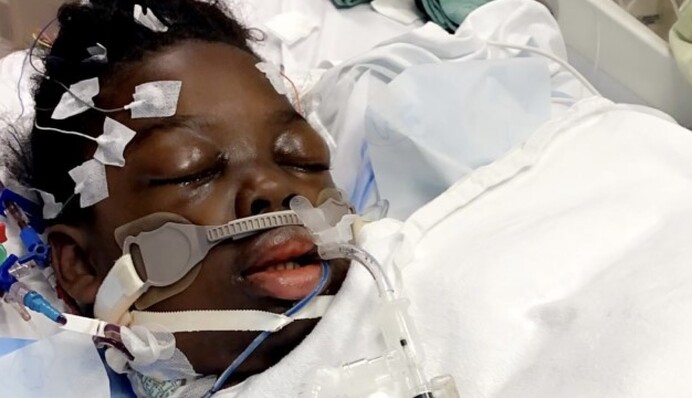 10-річному хлопчикові ампутують ноги через ускладнення COVID-19: фото і відео