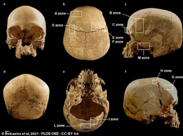 В Италии обнаружили череп женщины, жившей 5,4 тыс. лет назад, и узнали жуткую тайну: фото