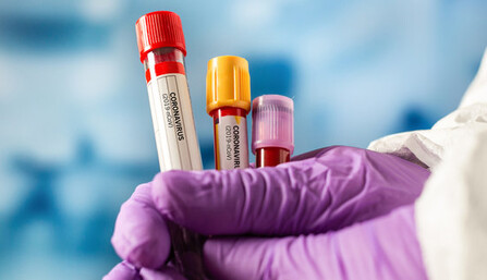 Медикам не вистачає знань: лікар-імунолог пояснила підступність коронавірусу