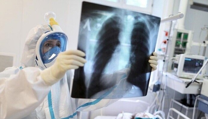 В Україні більше 600 нових випадків коронавірусу за добу: статистика на 7 липня