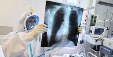 В Украине больше 600 новых случаев коронавируса за сутки: статистика на 7 июля