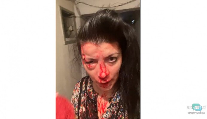 В Днепре зверски избили известную правозащитницу: вся в крови и сломан нос, видео