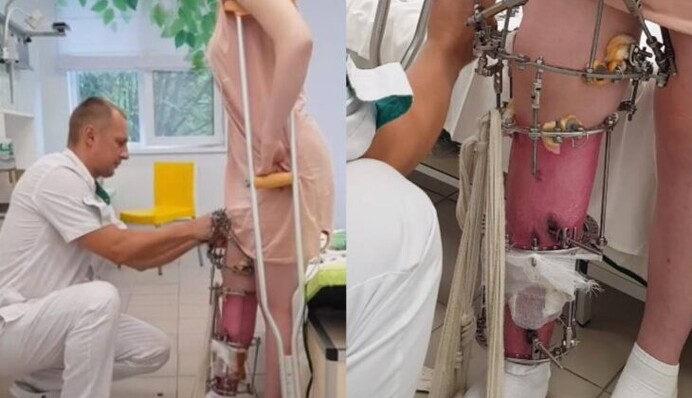 Лікарі творять чудеса: в Дніпрі хірурги провели унікальну операцію, фото