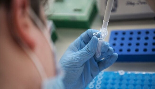 Штамм "Дельта" обнаружили в Украине в еще одном крупном городе: где можно привиться